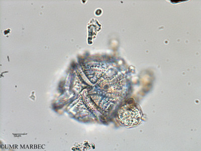 phyto/Bizerte/bizerte_bay/RISCO February 2015/Lingulodinium polyedrum (ancien Gonyaulax spinifera -ancien Baie_T5-ACW2-Gonyaulax-3).tif(copy)_thumb.jpg